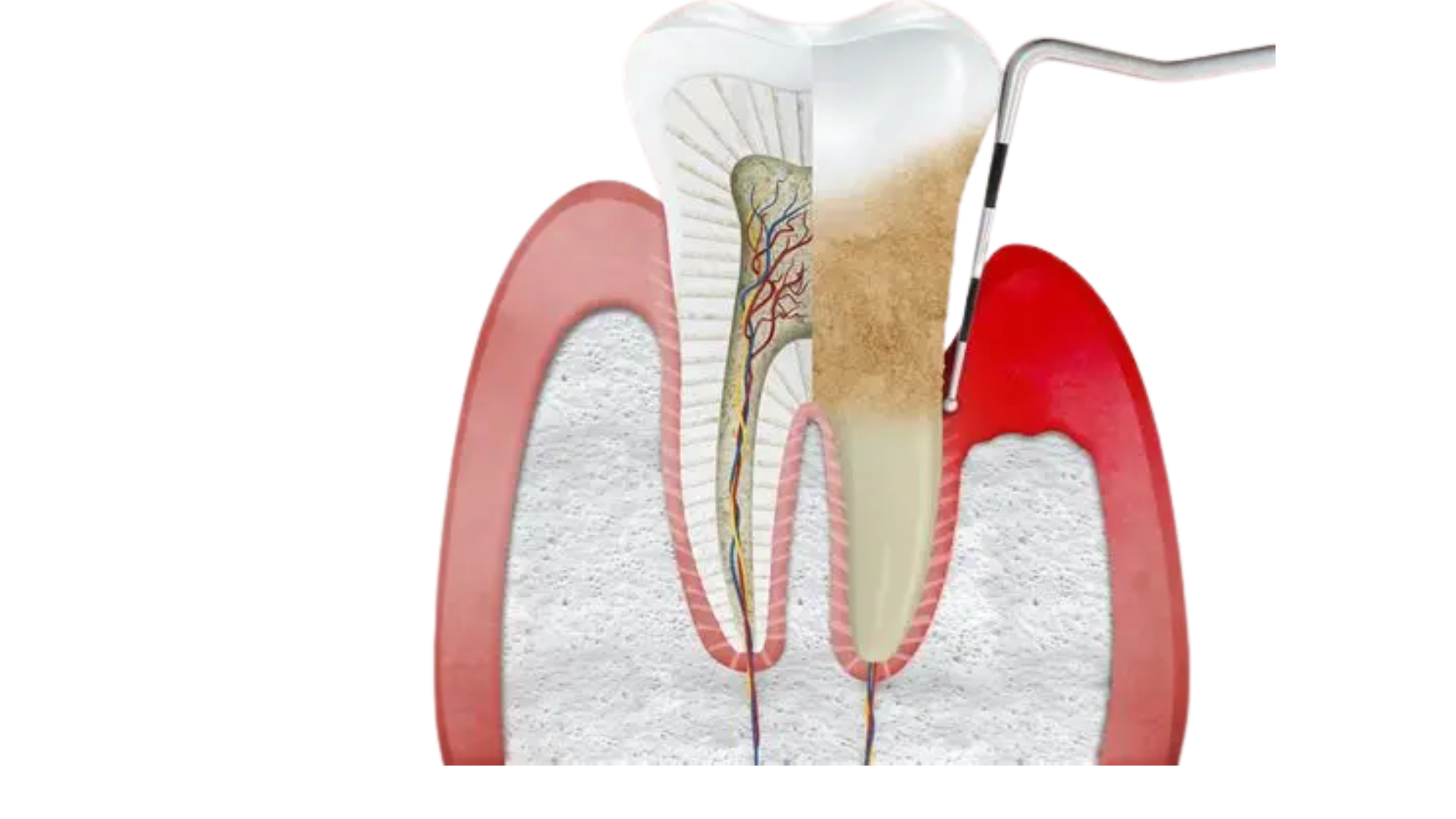Periodoncia UACH