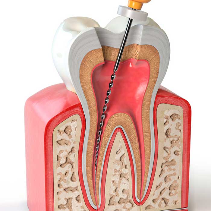 Endodoncia UACH