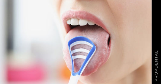 Tongue straps